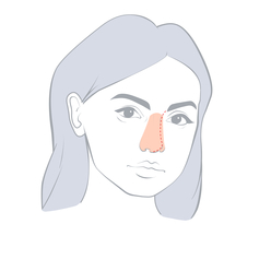 Nose Aesthetics